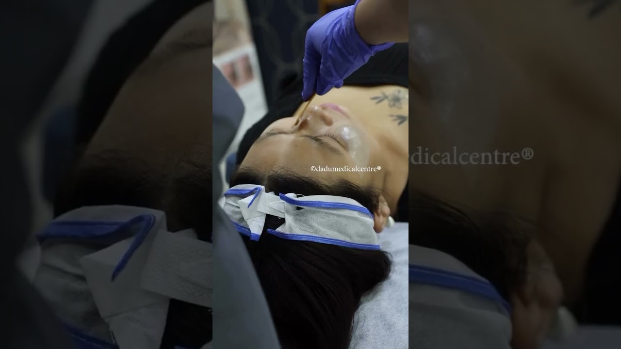 DMC-MAGIC BLEND &reg;️ | Advanced Pigmentation & Melasma Correction Treatment 🌿