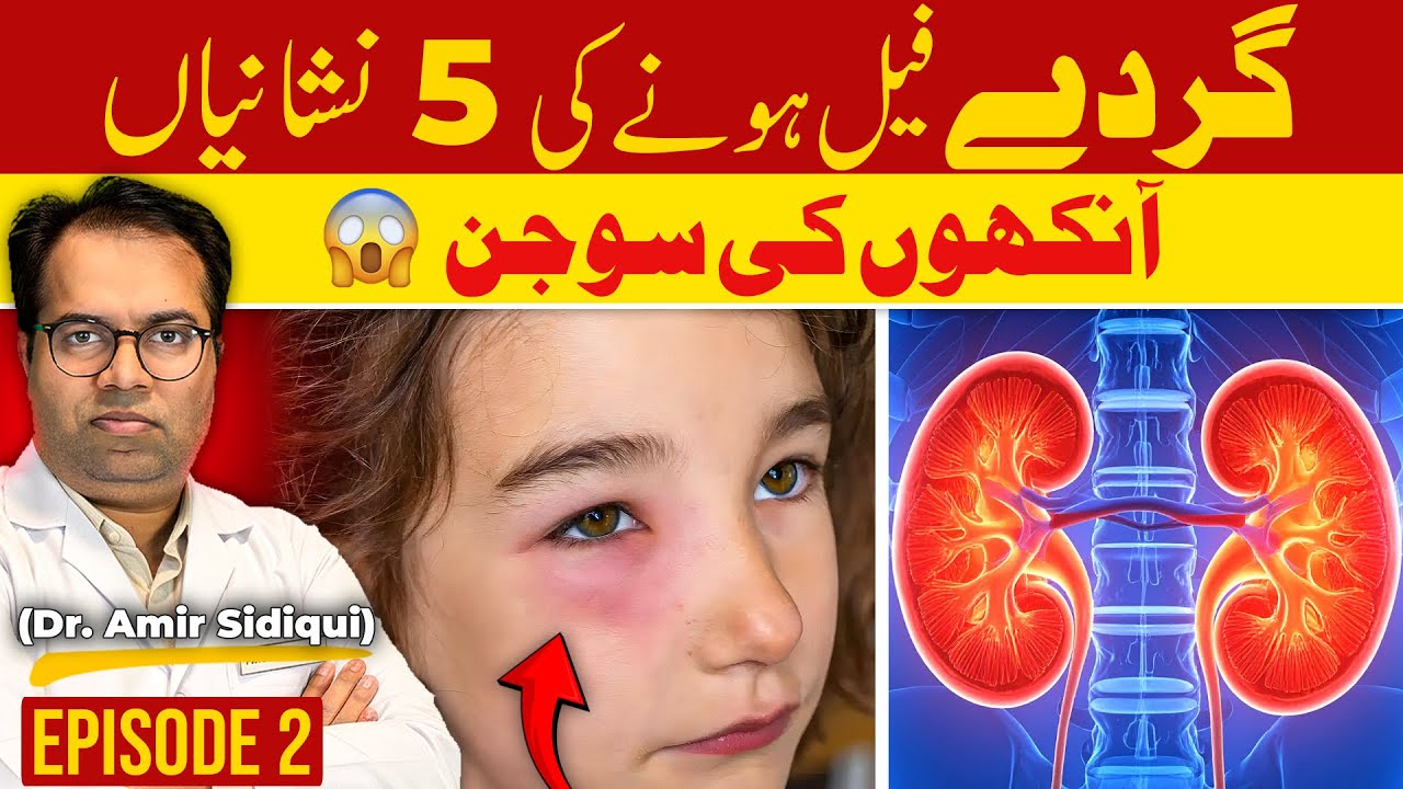 Kidney Failure ki 5 Khamosh Nishaniyan! 🚨 | Pharmacist Advice