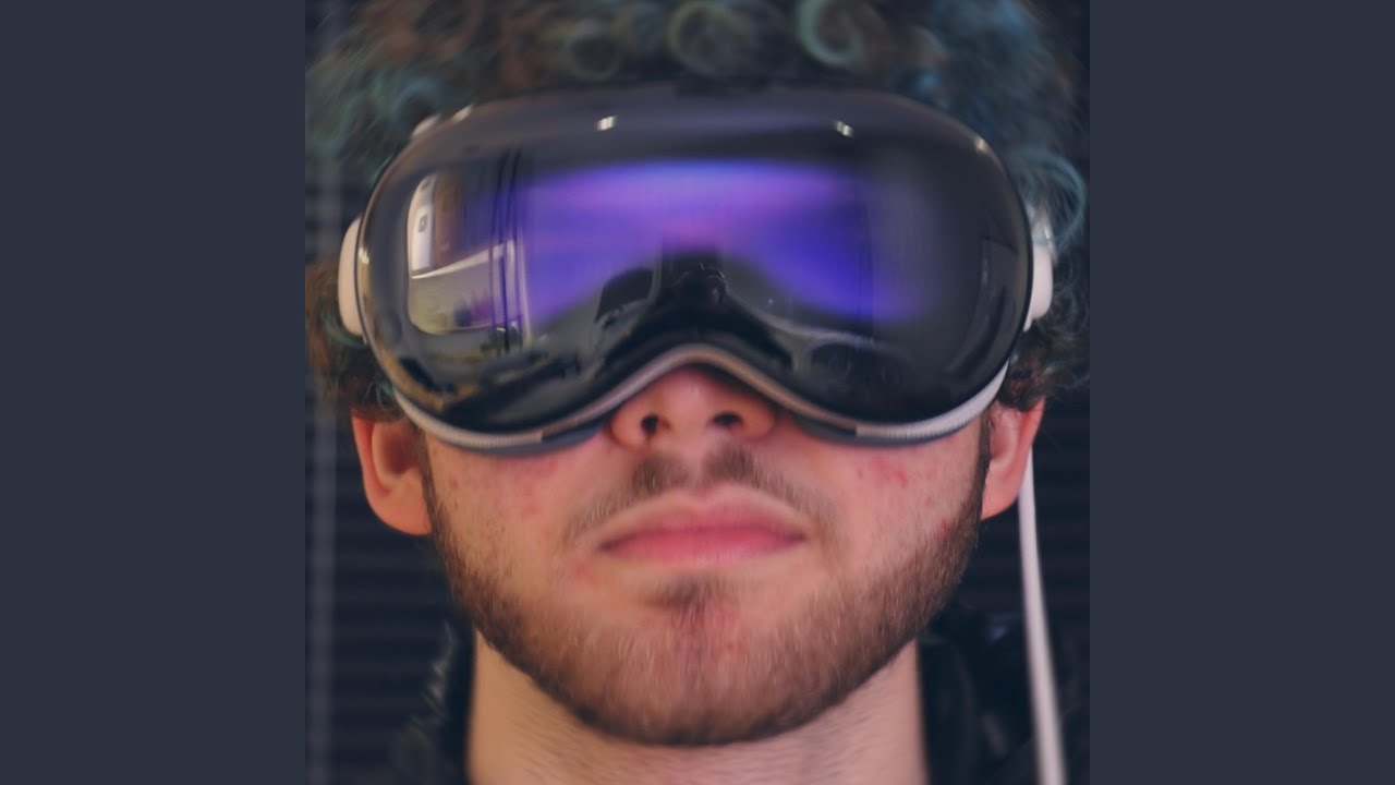 VISION