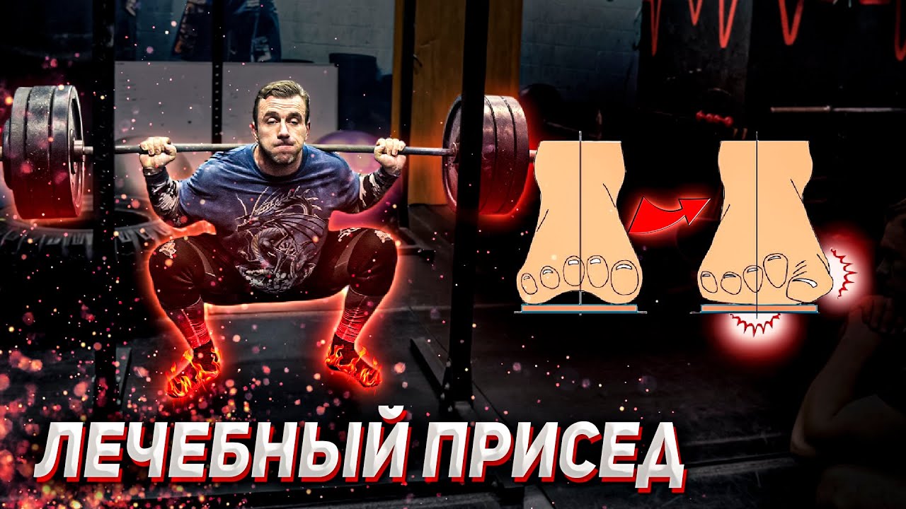 Приседальный эксперимент #4. Как нас защищают приседания? Плоскостопие. Вальгус.