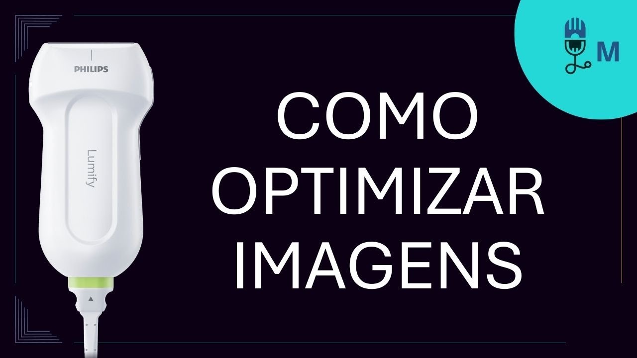 #57-Como Optimizar Imagens ao Ultrassom