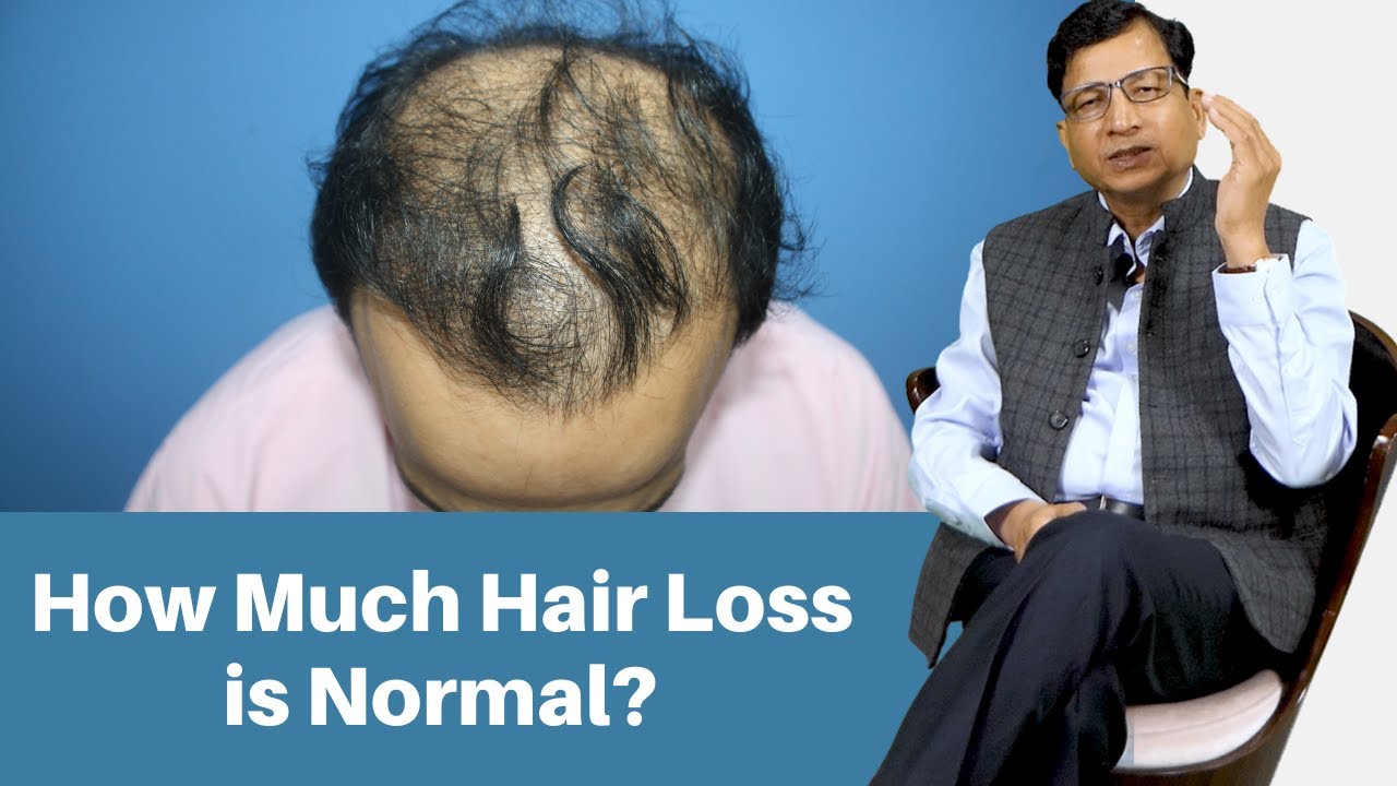 How Much Hair Loss is Normal? How You Can Stop It | Rejuvenate Hair
