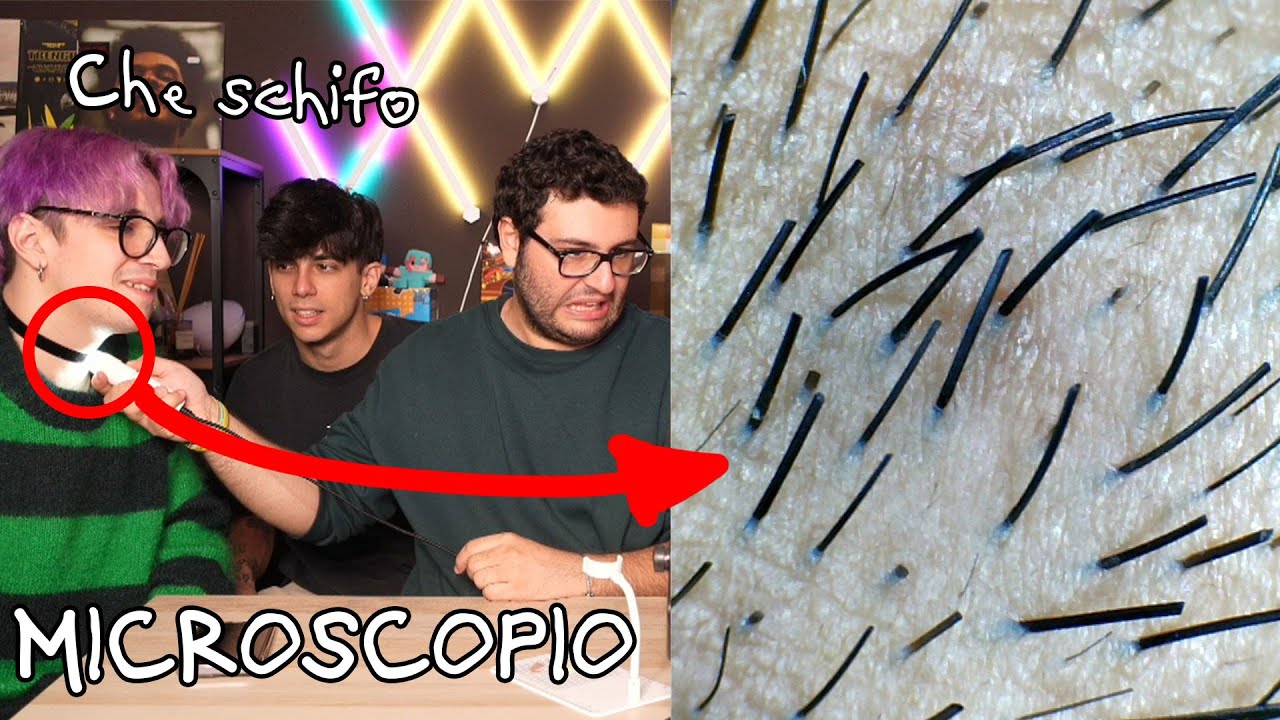 GUARDO NUTELLA DEL 2019 AL MICROSCOPIO 1000X