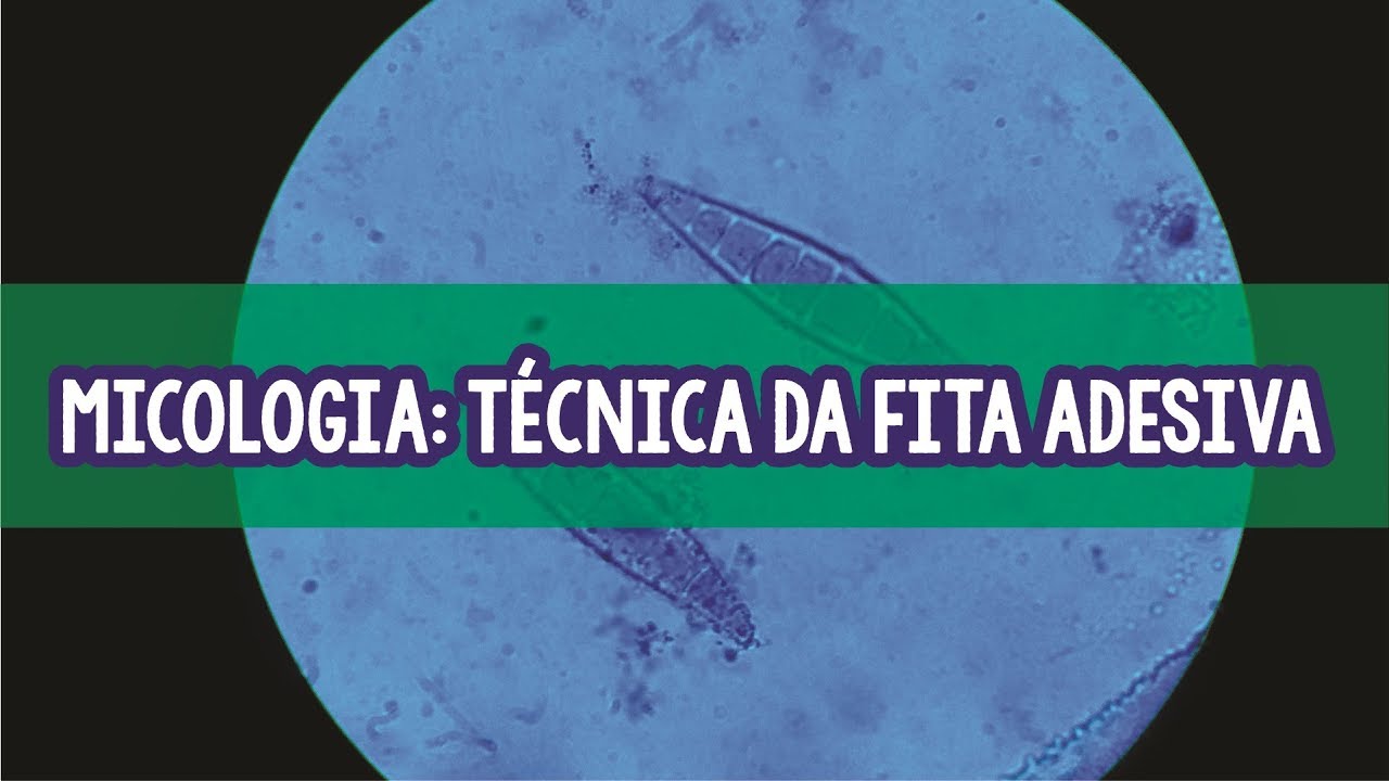 Como ver fungos no laboratório? | Técnicas Biomédicas