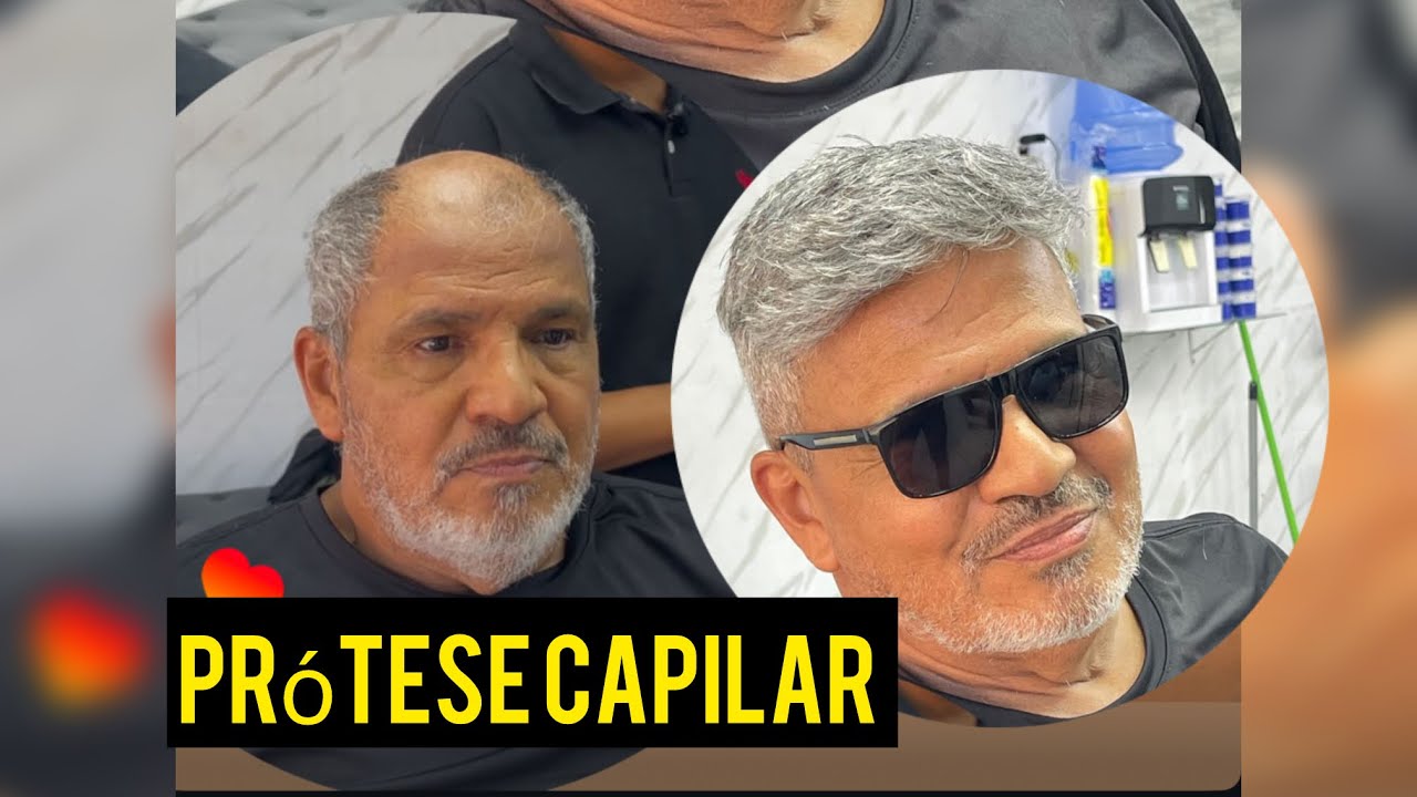 COMO COLOCAR PRÓTESE CAPILAR (tutorial completo)
