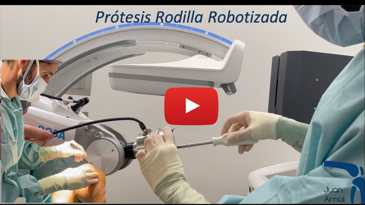 Prótesis con Robot (Rodilla):  Cirugía Completa