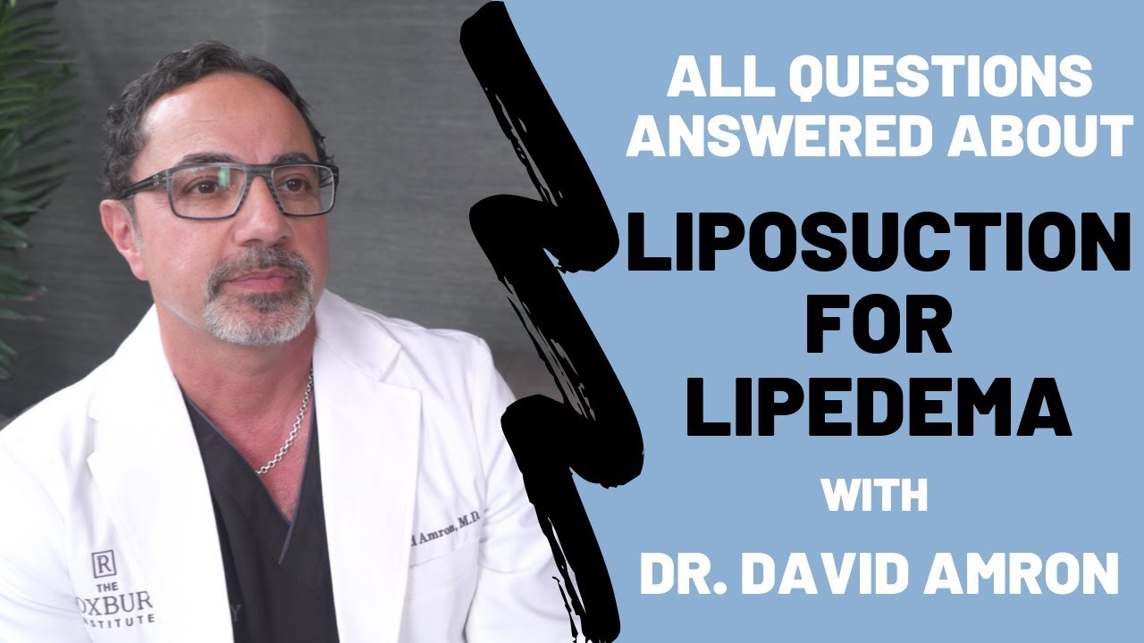 Liposuction for Lipedema Questions with Dr. David Amron