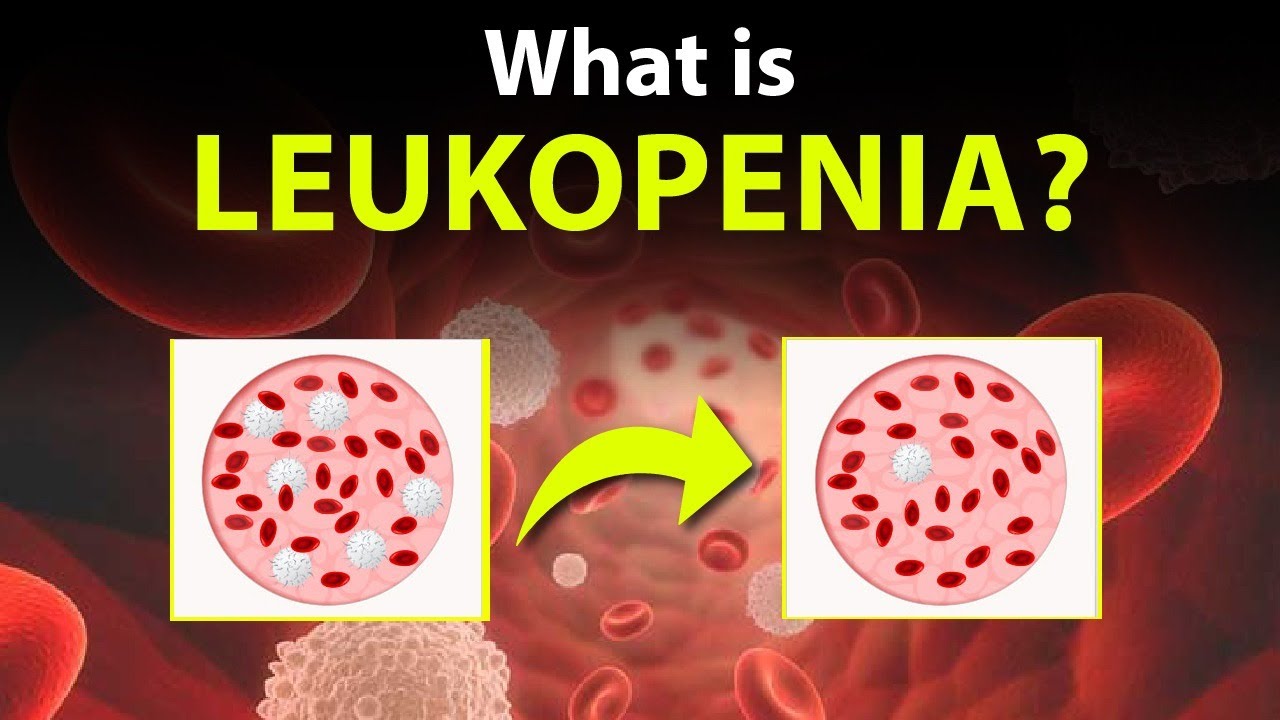 Let’s Know About the LEUKOPENIA?