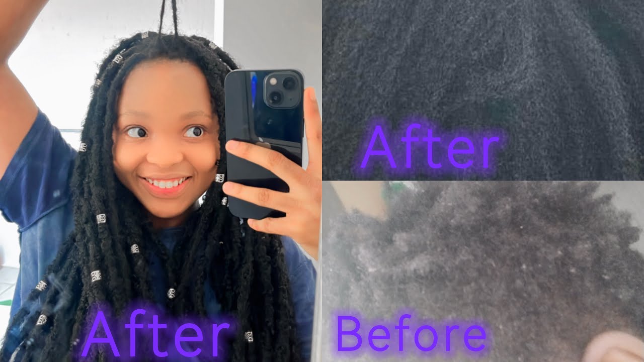 Hair loss journey *how I grew my hair with photo evidence before and after* South African YouTuber