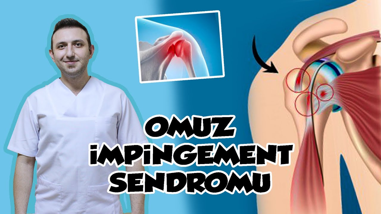 Omuz Sıkışması (İmpingement Sendromu) Nedir? // Kol Kaldırırken Ağrıya Son!