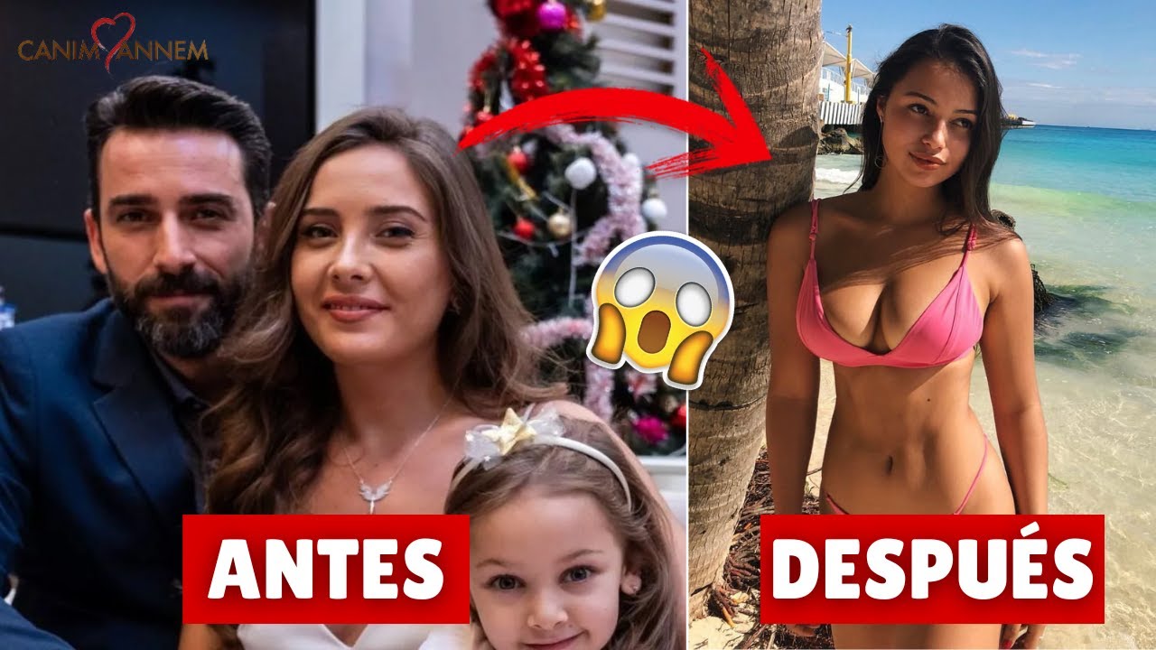 Antes y después de Mi Querida Madre (Canım Annem)