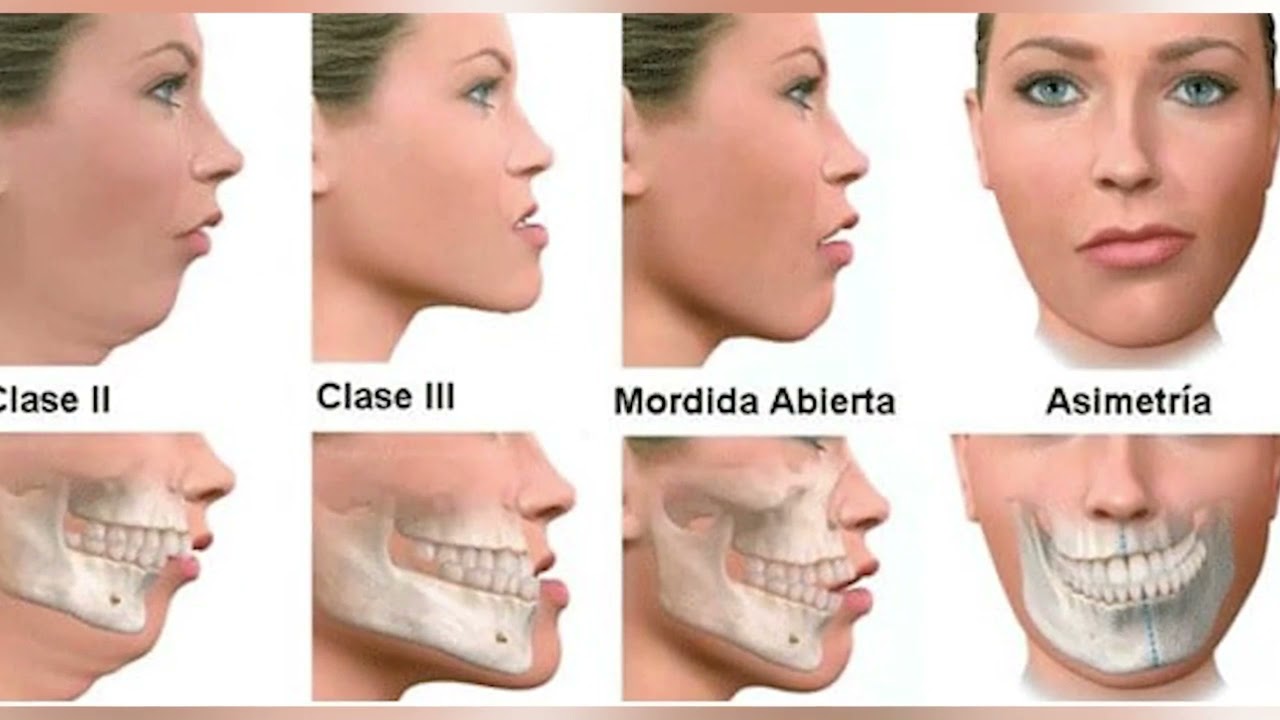 CIRUGÍA MAXILOFACIAL