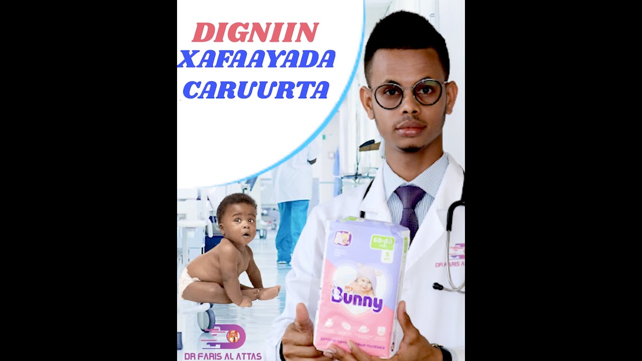 CASAANKA ama GADUUDKA AY XAFYAADA ILMAHA KU SAMEYSO IYO SIDA LOOLA TACAALO.