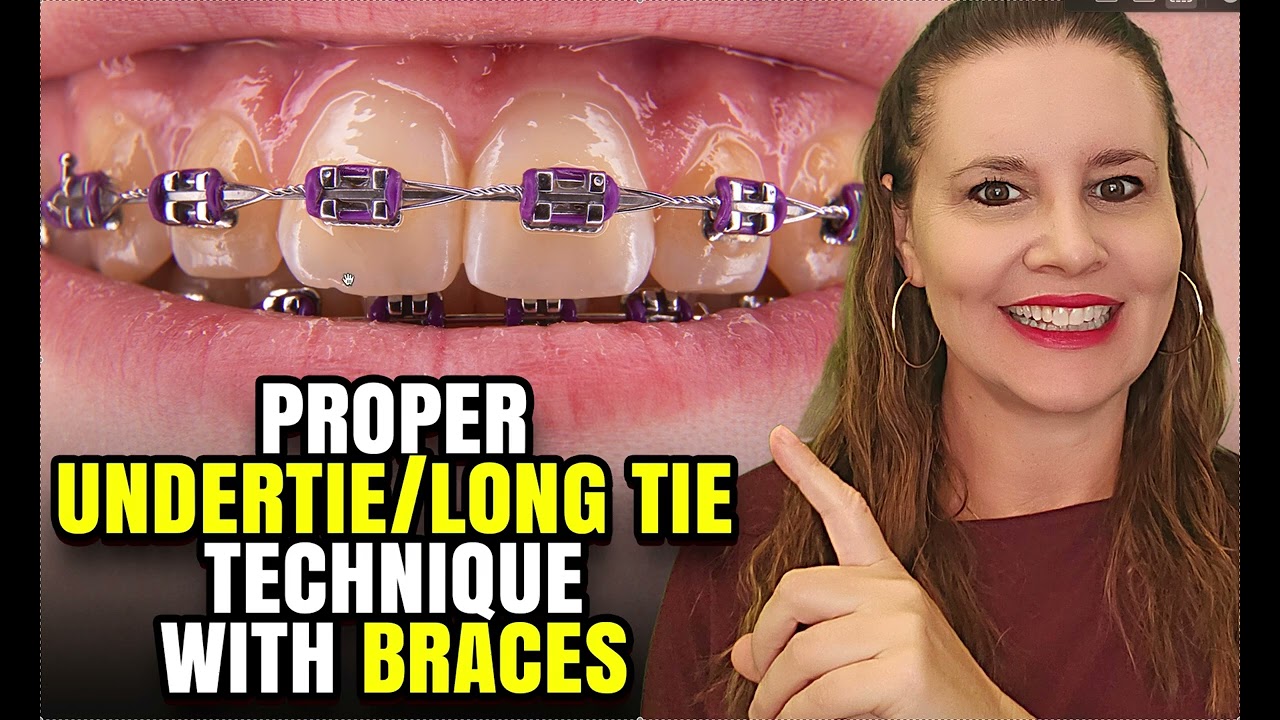 Proper Long Tie Under-tie Technique- Braces