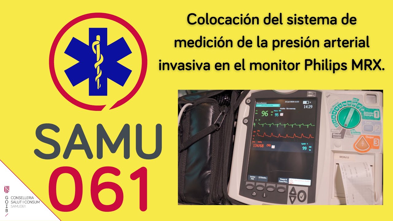 Colocación del sistema de medición de la presión arterial invasiva en el monitor Philips MRX.