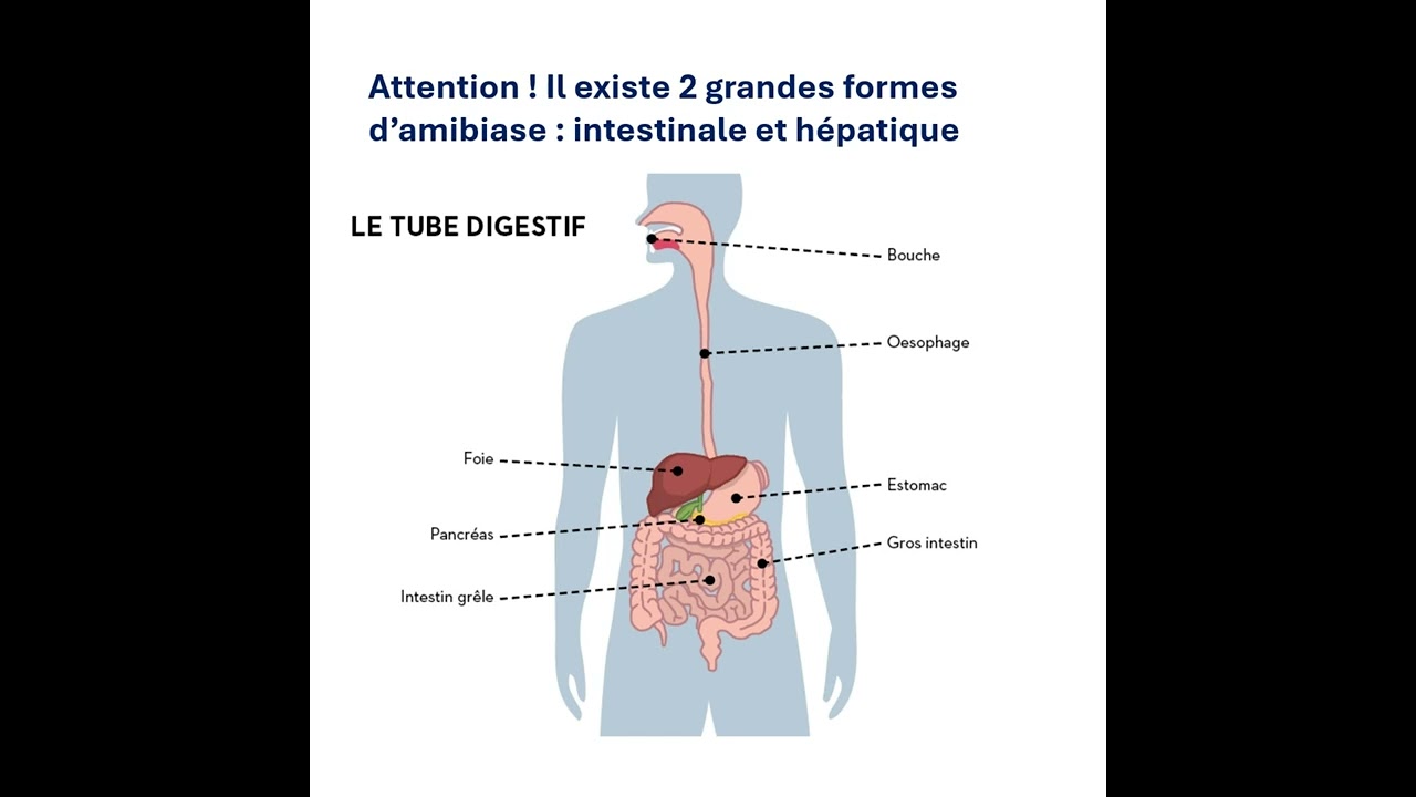L&rsquo;amoebose : ce qu&rsquo;il faut savoir