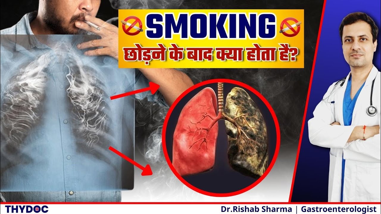 धूम्रपान छोड़ने के बाद क्या होता है? | Smoking Withdrawal Symptoms | Smoking छोड़ने के फ़ायदे