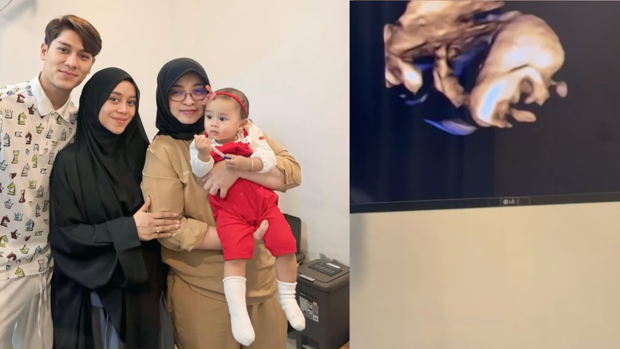 LIVE LESTIKEJORA & RIZKYBILLAR, SPIL USG DEDE UTUN, TETEH LESHIA CANTIK BANGET🥰