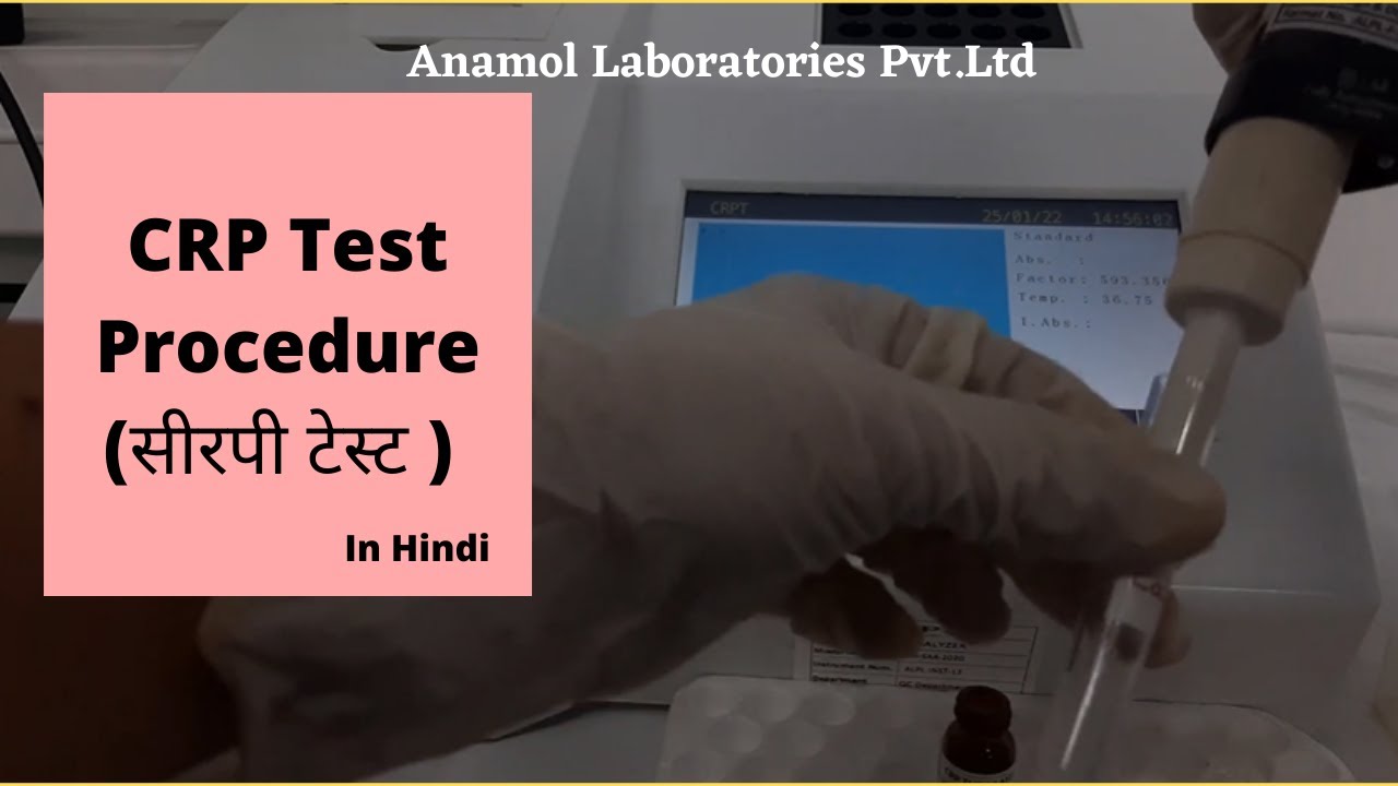 CRP Turbilatex Procedure Video - Hindi
