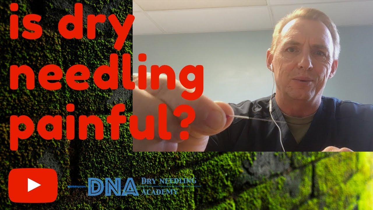 Is Dry Needling PAINFUL?????