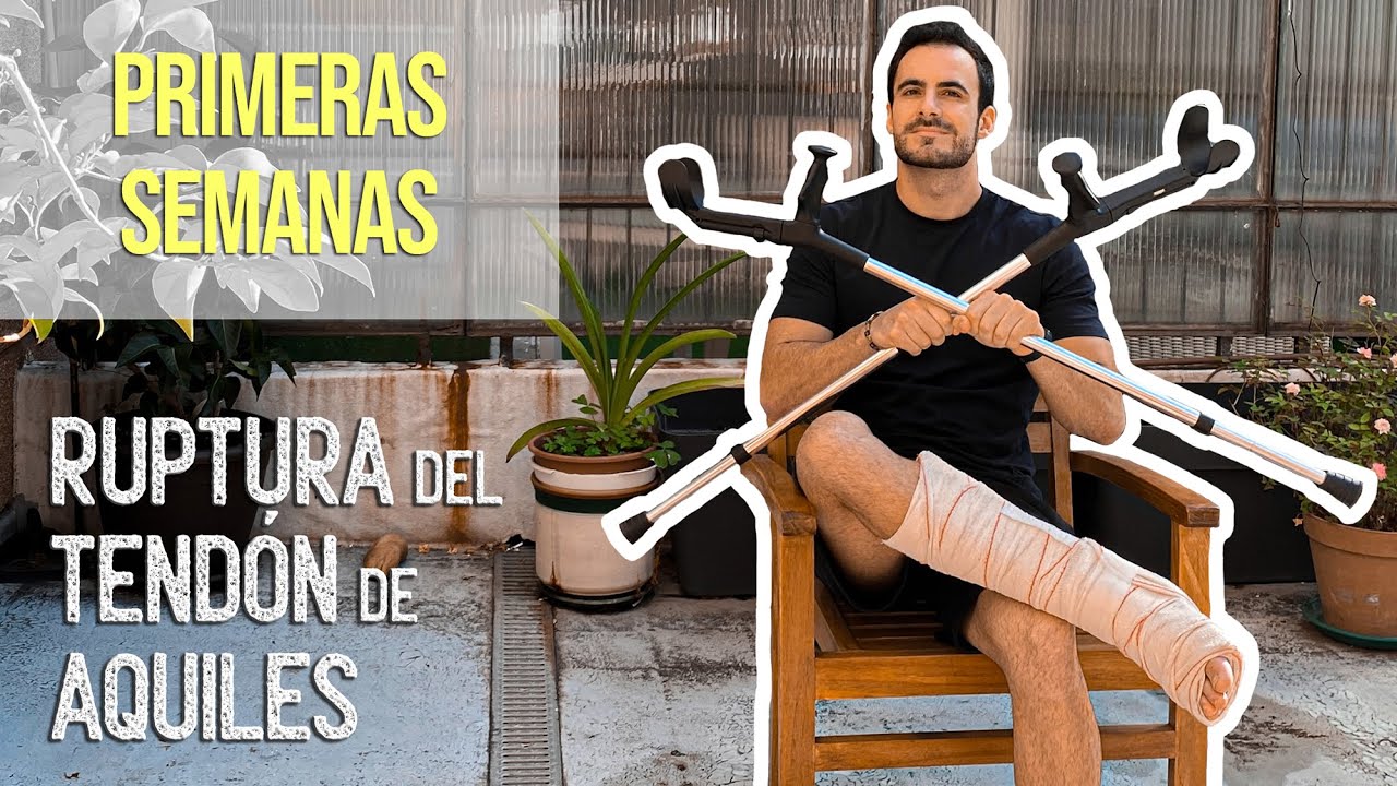 ROTURA TENDÓN DE AQUILES. MI EXPERIENCIA (3 SEMANAS)