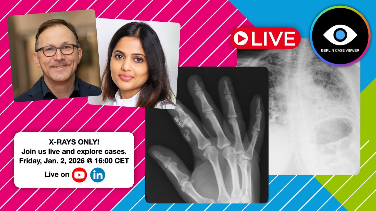 X-RAYS ONLY: When Bones and Lungs Talk – Scleroderma, Sarcoidosis & Friends