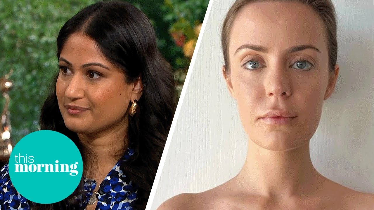 Everything You Need To Know About The ‘Barbie Botox’ Craze | This Morning