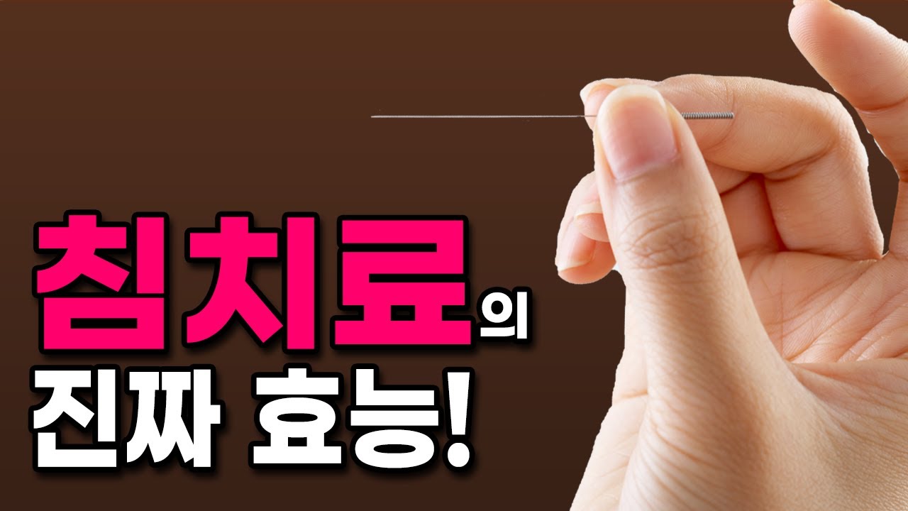 침 치료, 진짜 효과 있다고? 침 맞으면 몸에 무슨 일이 일어날까?