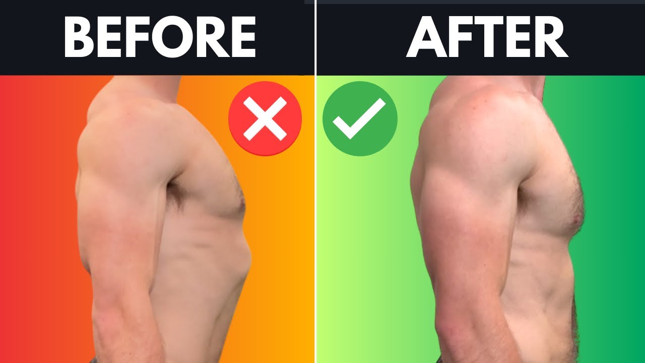 How To Fix Your Rib Flare With 1 Easy Exercise