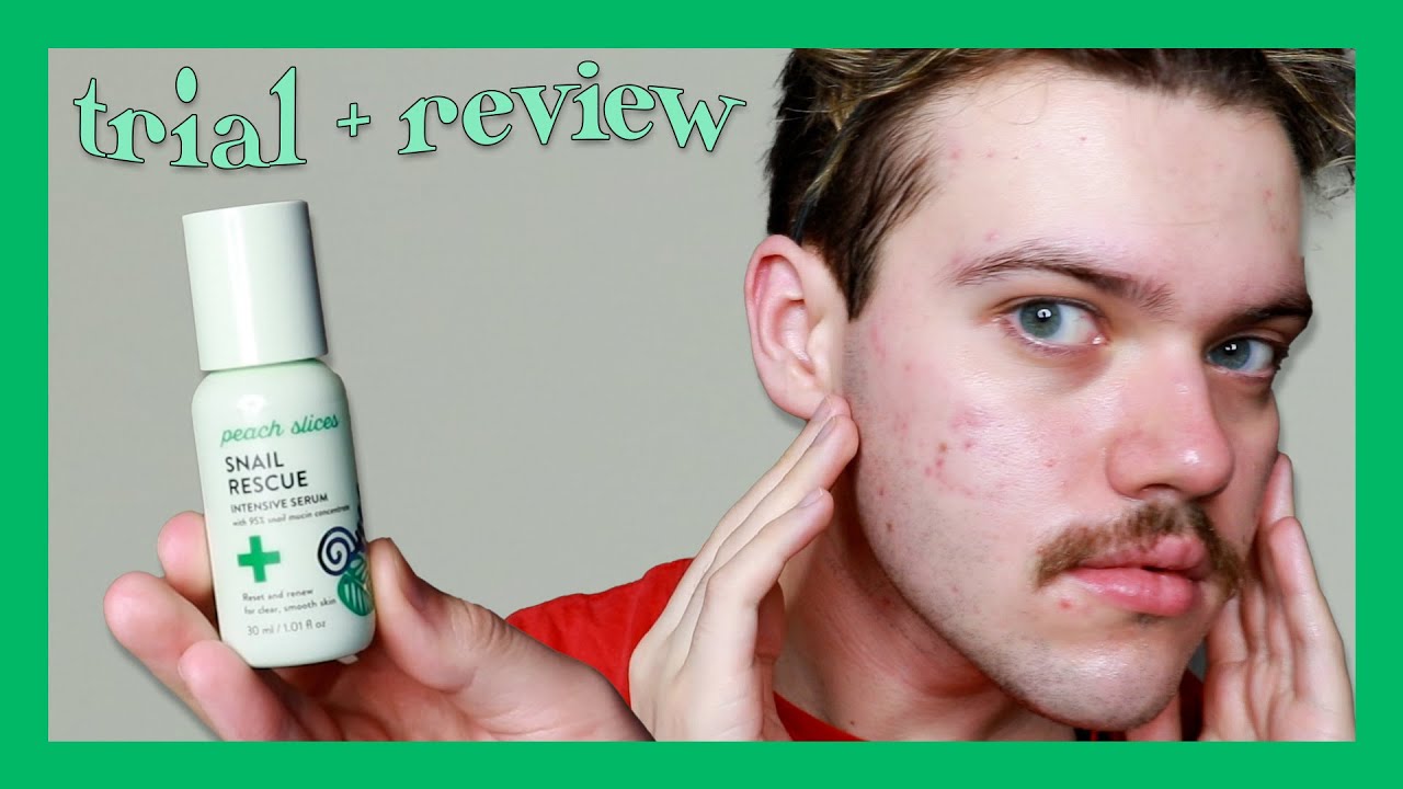 peach slices snail rescue intensive serum | trial + review