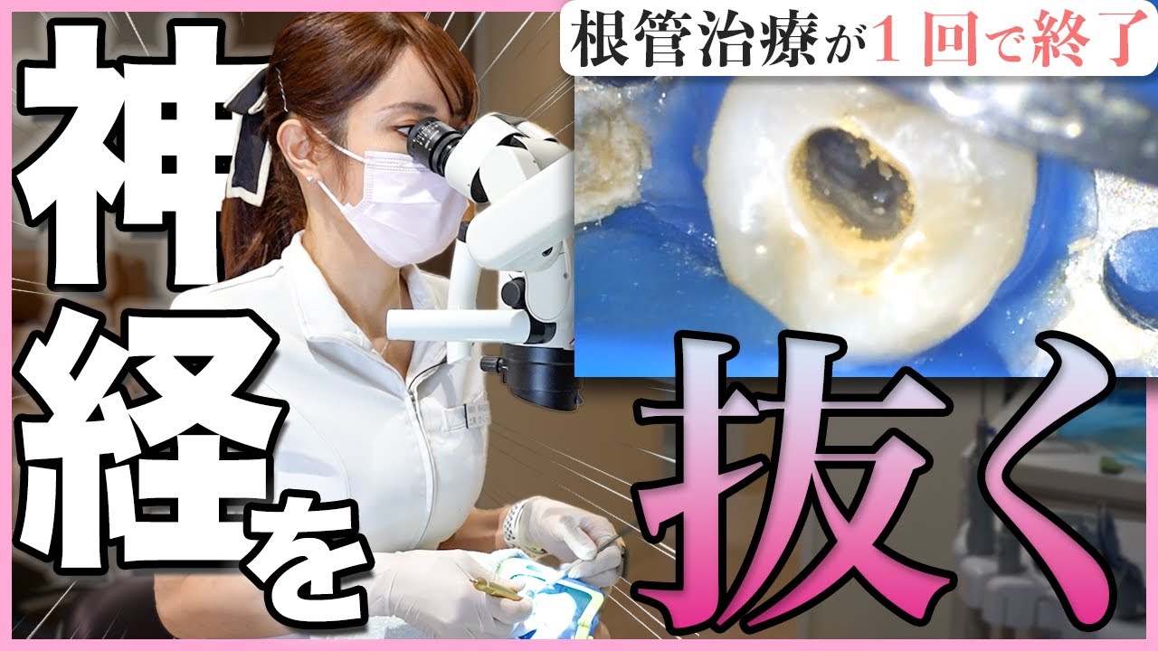 歯の神経を抜く！ 最先端の根管治療の全てを見せます。【最新版】(マイクロスコープ&ラバーダム)
