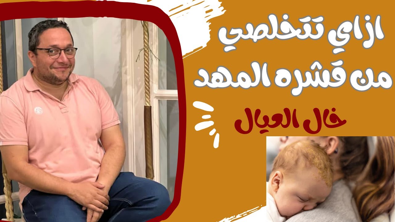 ازاى تتخلصى من قشره المهد عند الاطفال
