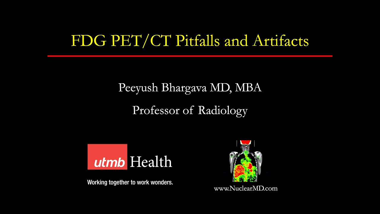 FDG PET/CT Pitfalls and Artifacts