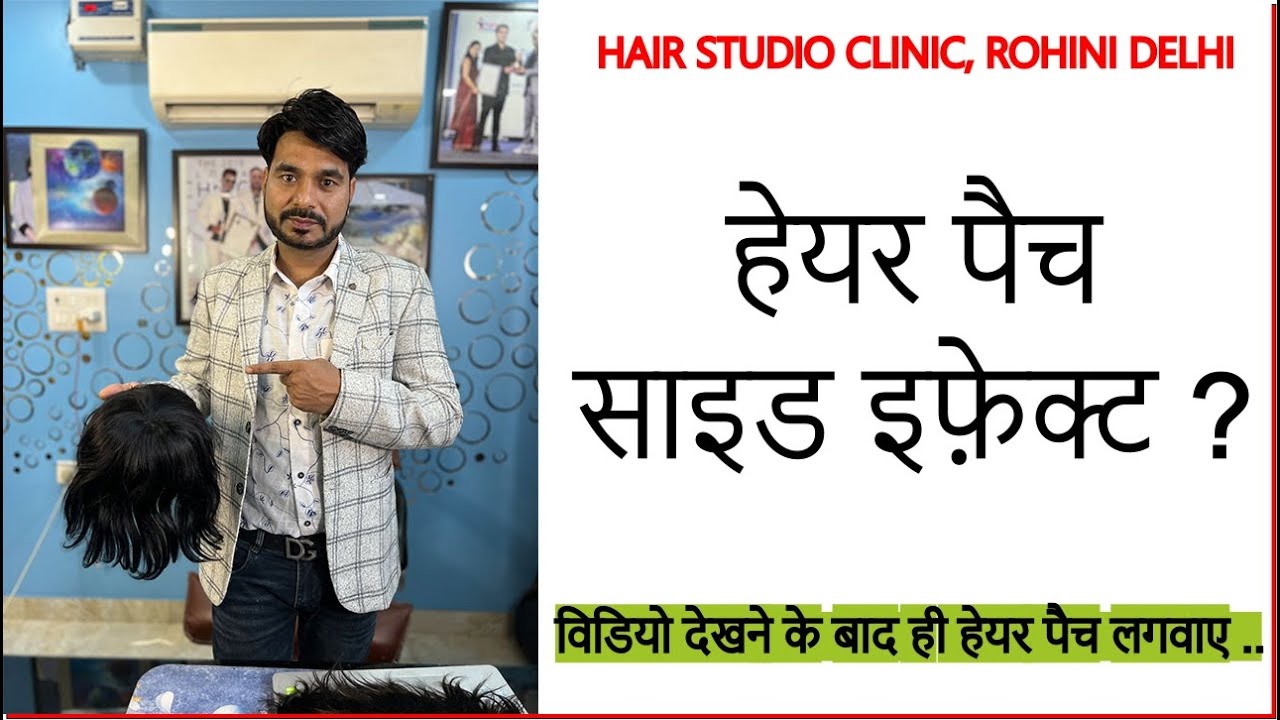 Side Effects of Hair Patch & Wig / हेयर पैच के साइड इफेक्ट