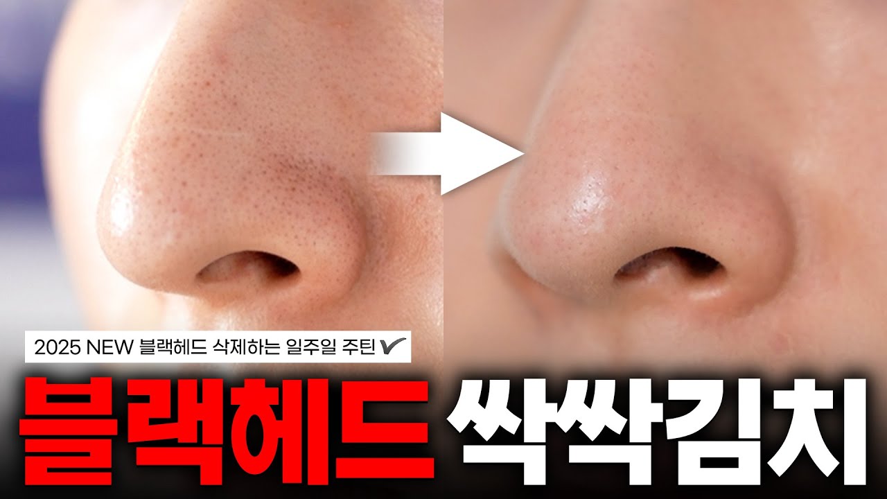 무조건 효과 봅니다..‼️현시점 가장 