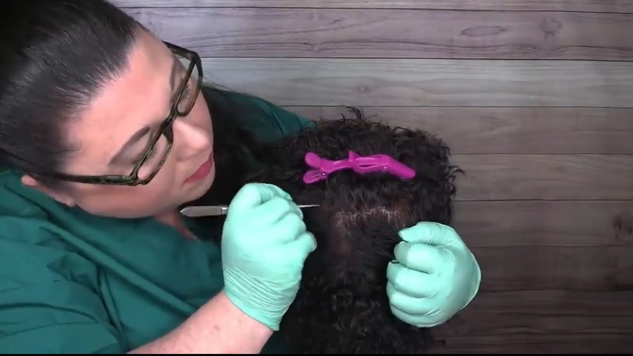 ASMR Scalp Check and Treatment (Afro/Kinky Hair, Scalp Massage) Medical Roleplay