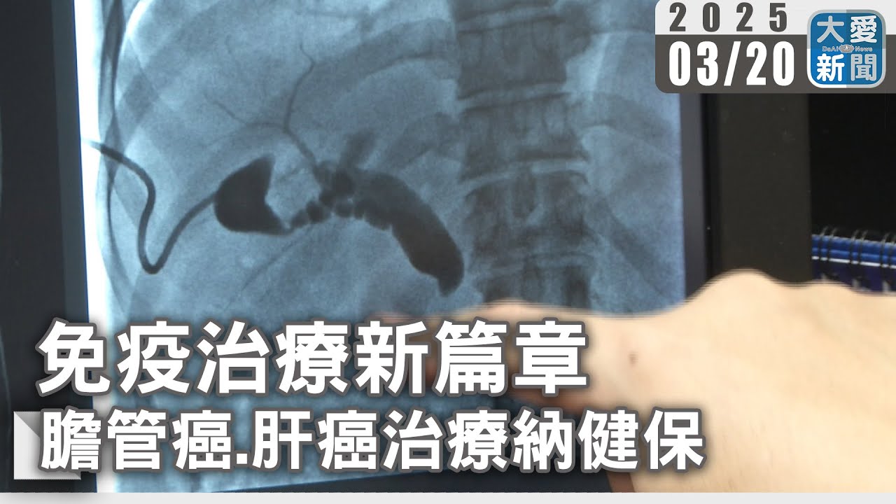 免疫治療新篇章&nbsp;&nbsp;膽管癌.肝癌治療納健保｜大愛新聞   @DaaiWorldNews