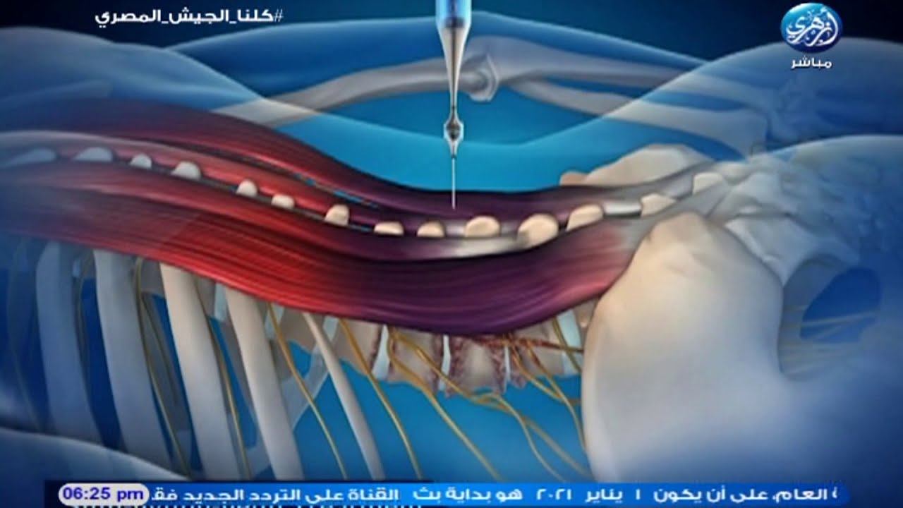 خطوة بخطوة    ازاي بنبدأ مرحلة العلاج في اسيا كلينيك بدون جراحة حتى الشفاء ؟