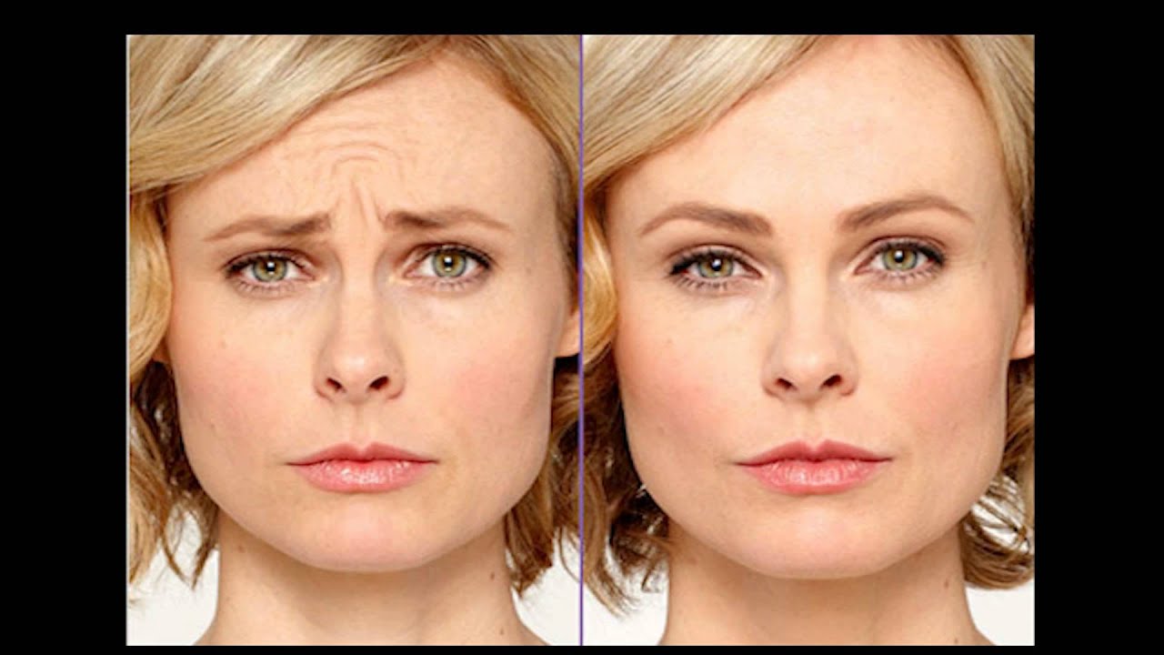 Dr. Daniel Daube Explains - Botox: It's Not Magic. It's Medicine