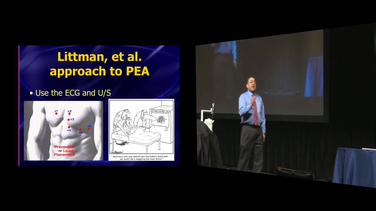 Cardiac Arrest and ACLS in 2015 - Amal Mattu - Resuscitation 2015