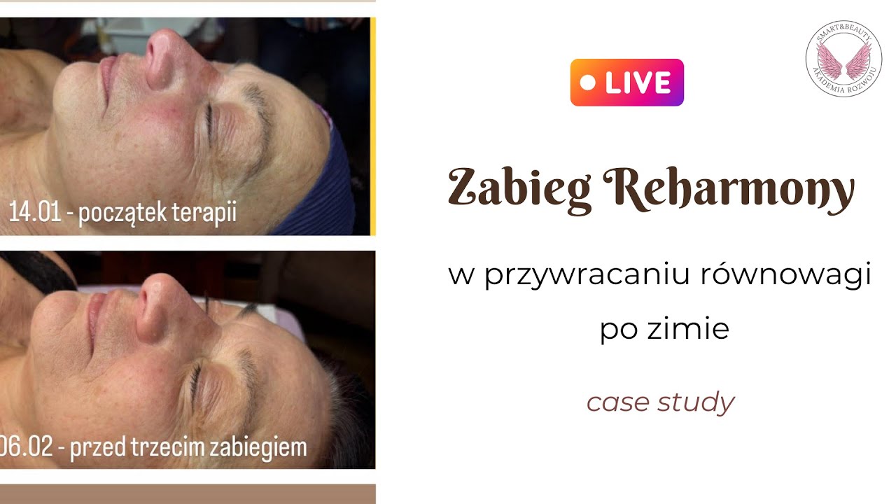 Gdy standardowe zabiegi nie wystarczają – regeneracja skóry po zimie