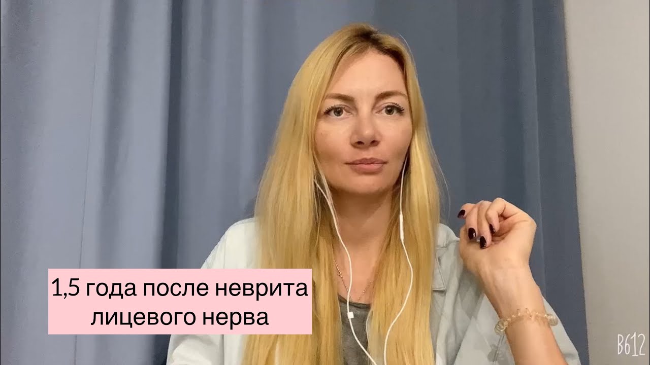 почти 1,5 года после неврита лицевого нерва