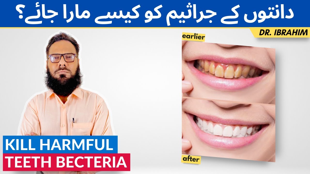 How to Remove Teeth Bacteria - Clean Dirty Yellowish Teeth Tartar/Plague Fast - Dr. Ibrahim