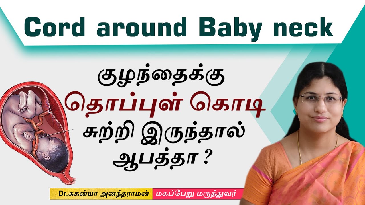 Cord around Baby neck | குழந்தைக்கு தொப்புள் கொடி சுத்தியிருந்தால் ஆபத்தானதா ?