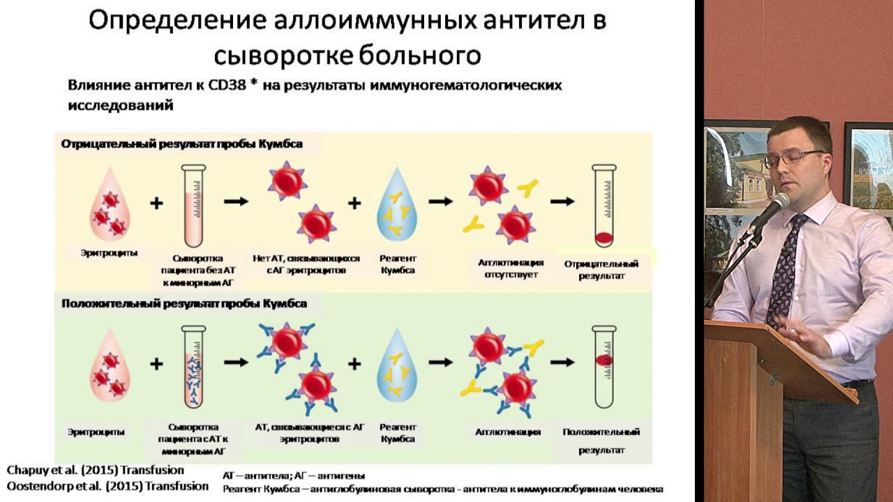 ВОРОБЬЁВ В.И., Практические аспекты терапии анти-CD38 антителами.