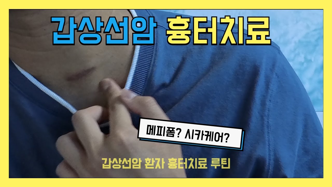 갑상선암 흉터치료, 흉터치료 연고 밴드 추천 | 갑상선암 수술 후 한 달 차 후기