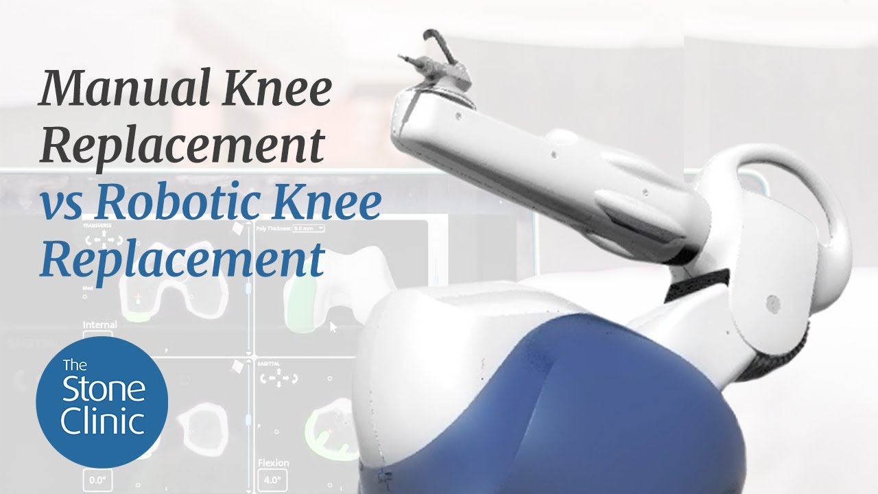 Robotic Knee Replacement vs. Manual Knee Replacement - What You Need To Know