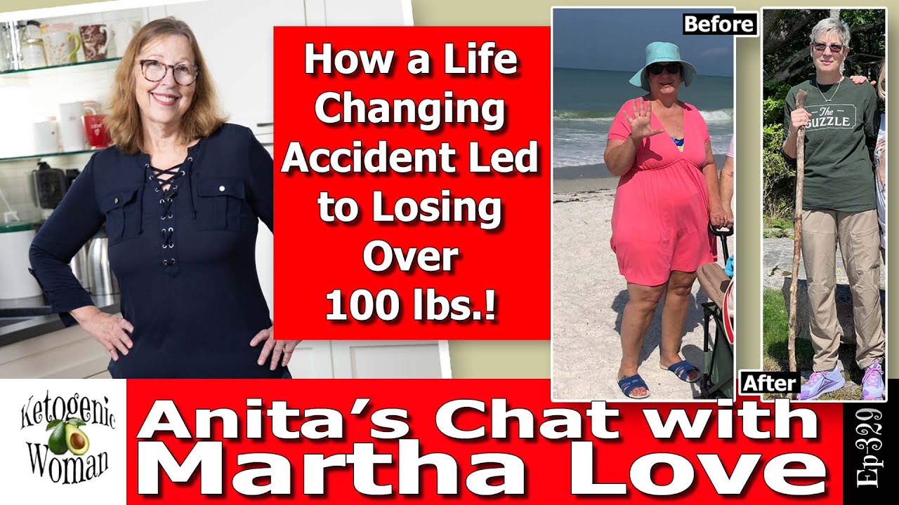 How Martha Overcame a Terrible Accident and Lost Over 100lbs | Her Weight Loss Story