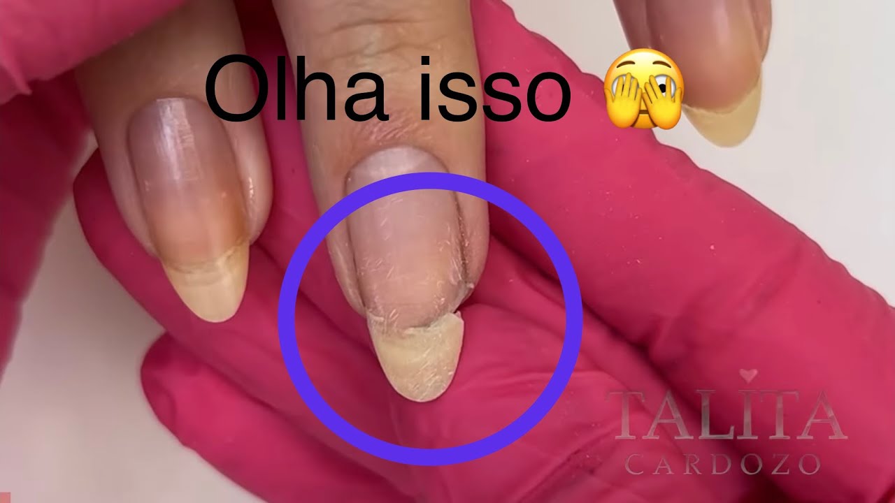 Como arrumar unha quebrada