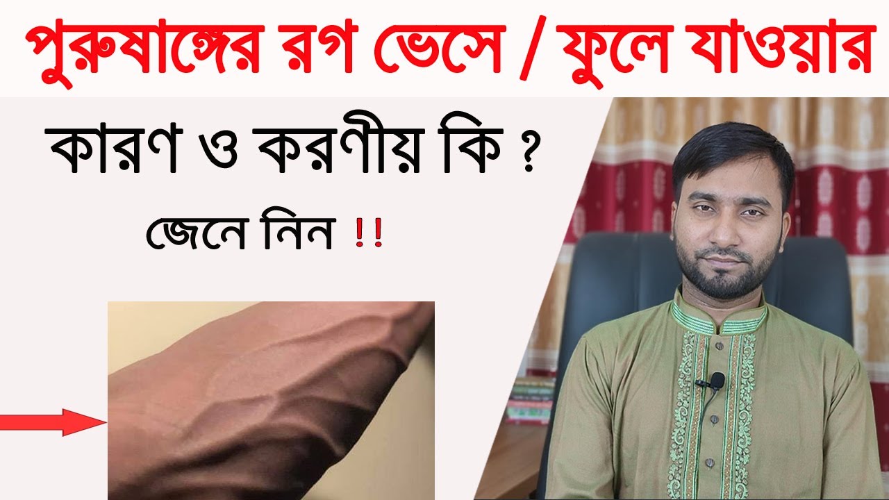 পুরুষাঙ্গের শিরা বা রগ ভেসে/ফুলে গেলে করণীয় কি ? ফুলে যাওয়ার কারণ কি !!